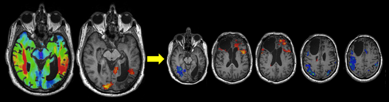 imaging example for website.png