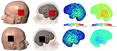 tDCS modeling for website-small.png