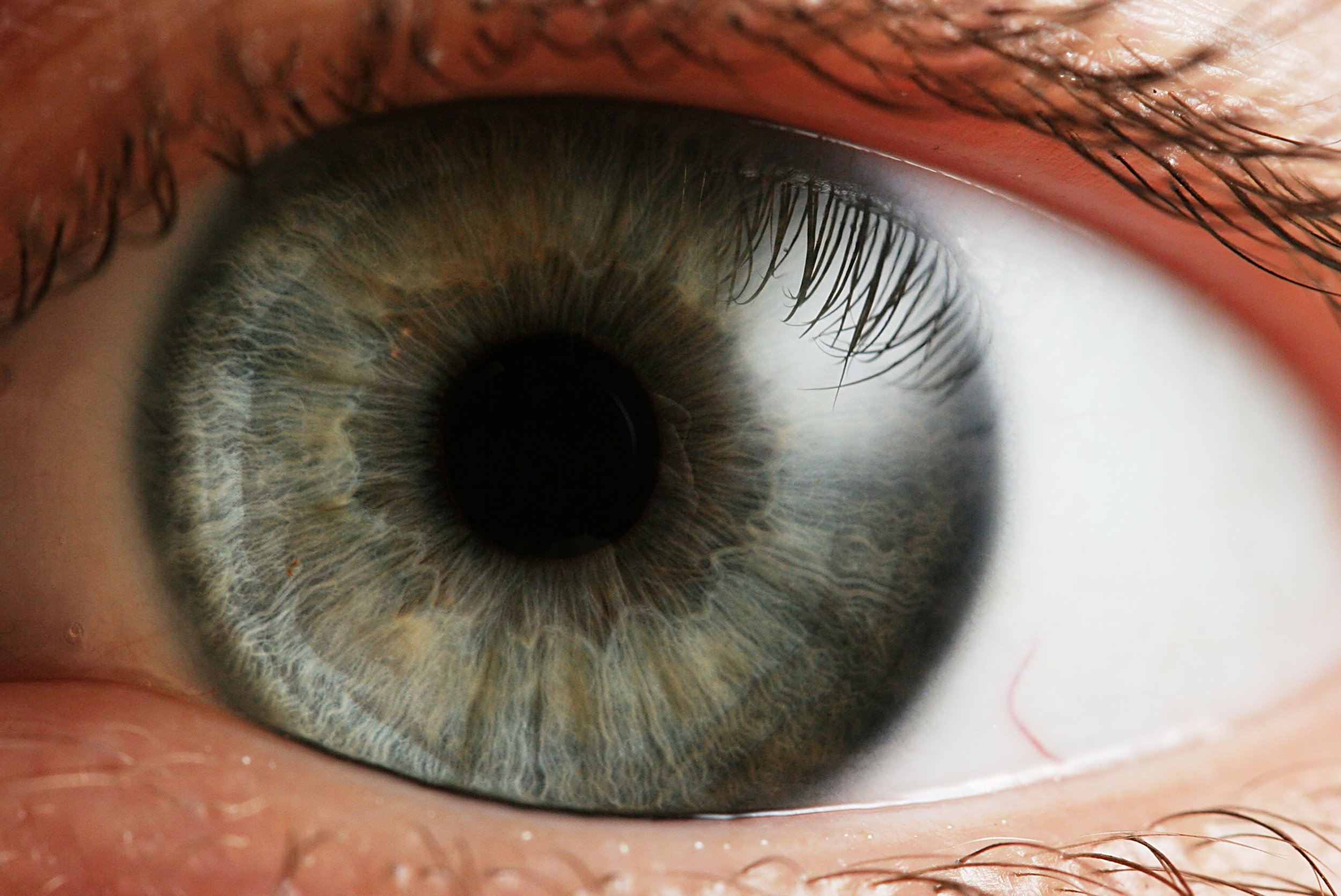 Eye-Gaze Technology Allows Communication-Impaired to Speak