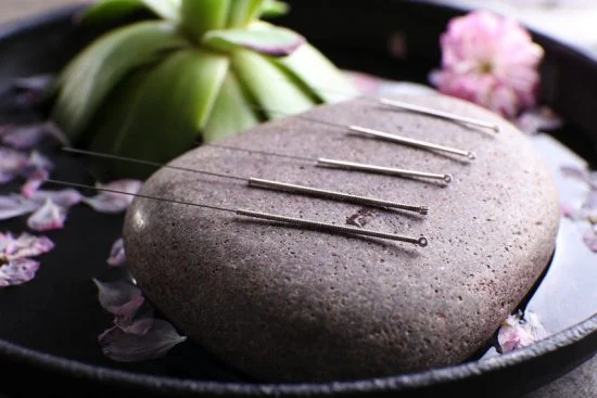 5-acupuncture-1-550x367.jpg