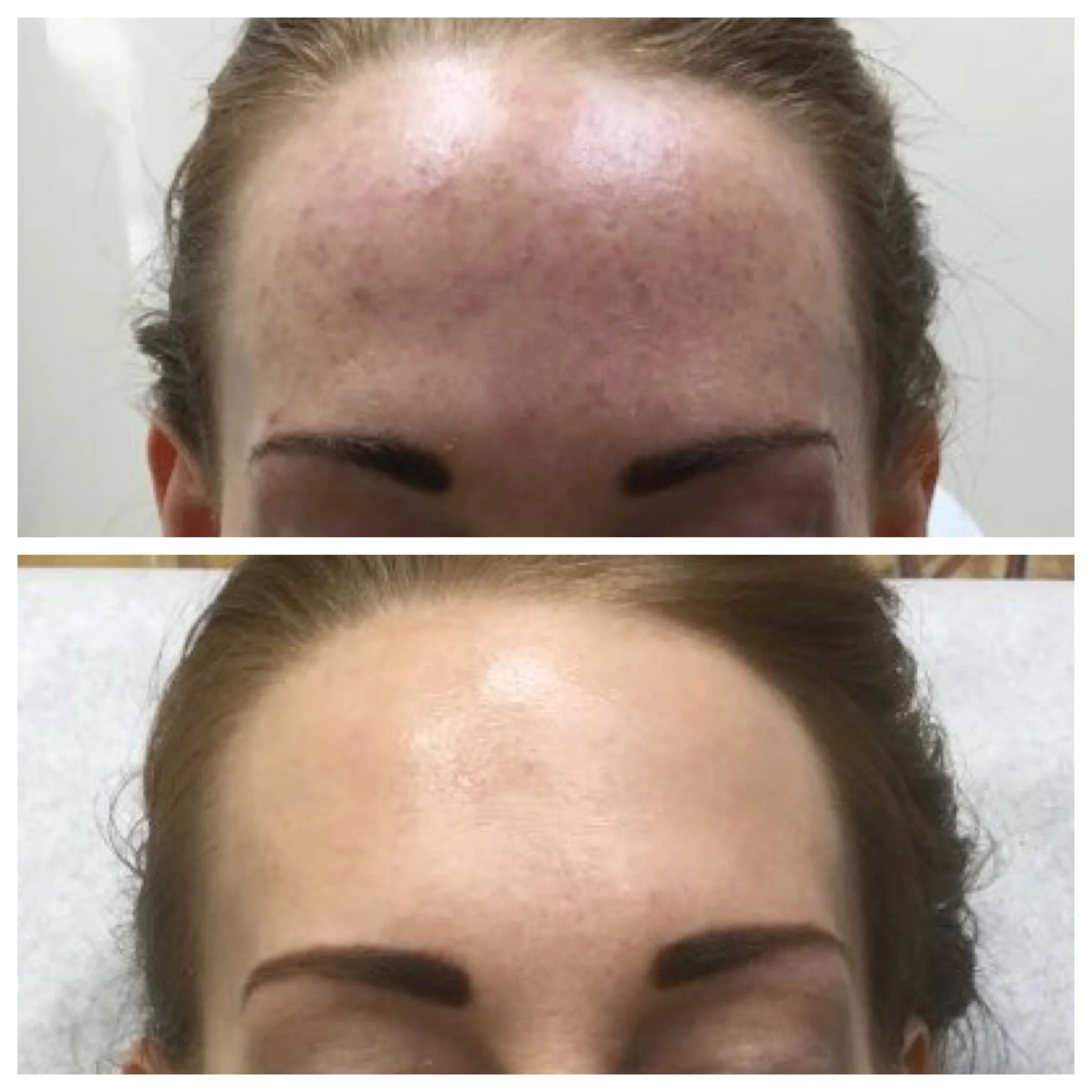 Brown Spots