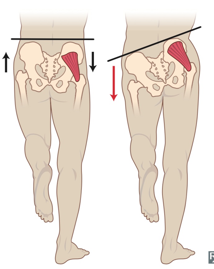 Iliotibial Band Friction Syndrome — Brookvale Physio