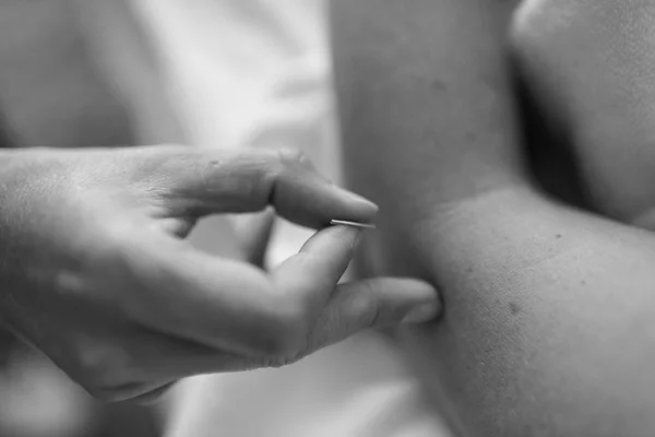 Acupuncture services in Revelstoke