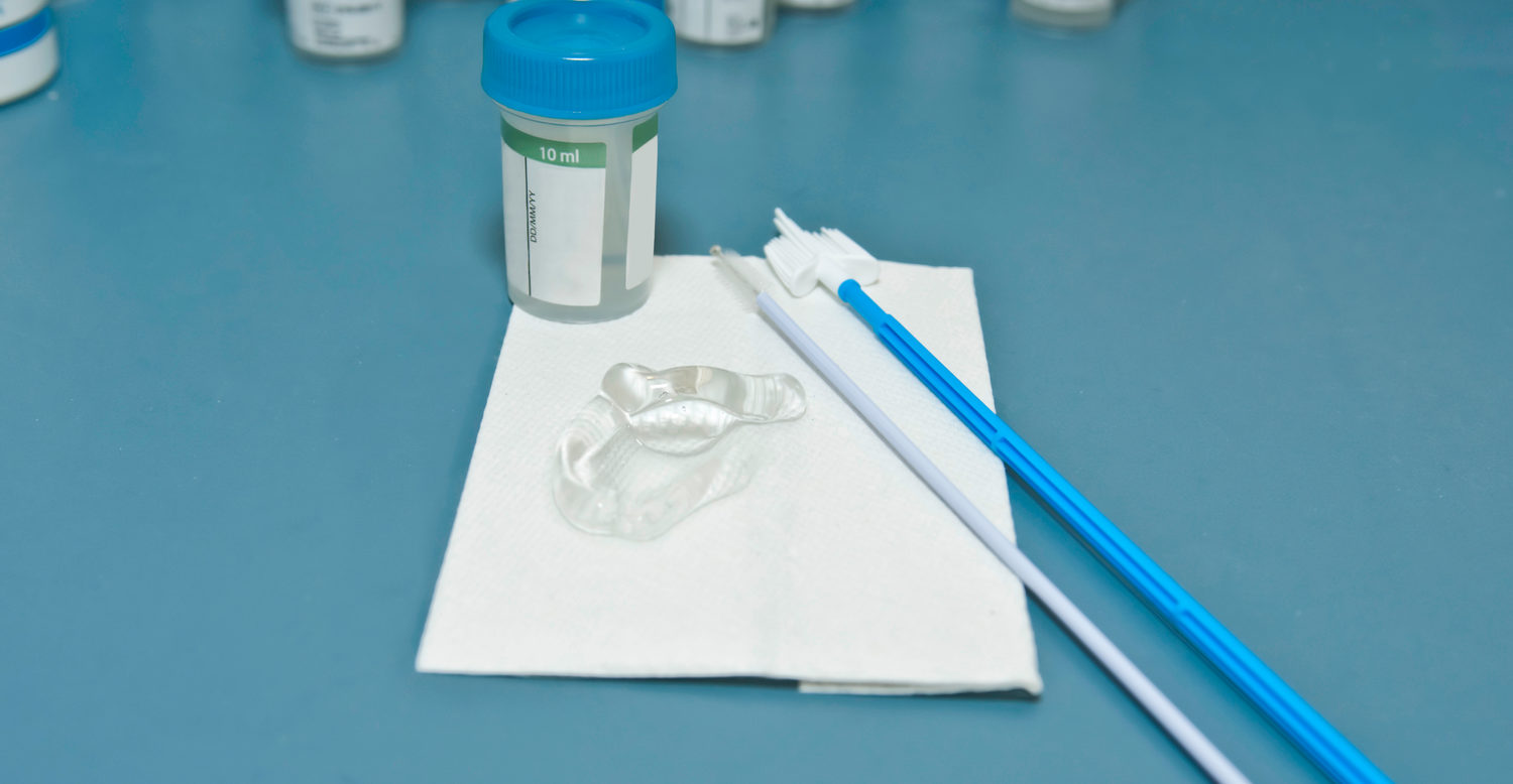 pap-smear.jpeg
