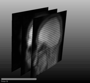 This is my brain in motion captured using tagged MRI.