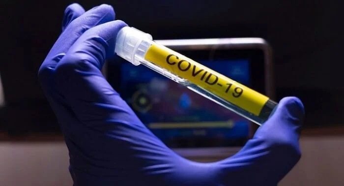vacuna-covid-laboratorio.jpeg