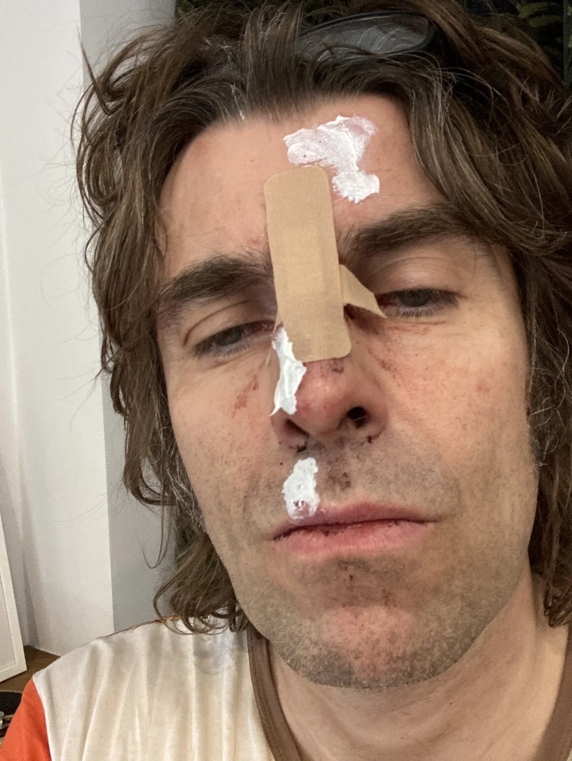 Liam Gallagher pospone concierto por su caída de un helicóptero 