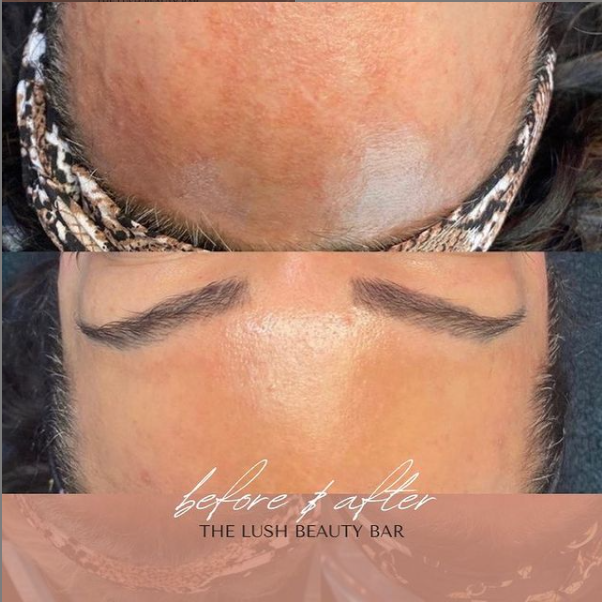 before and after 2.PNG