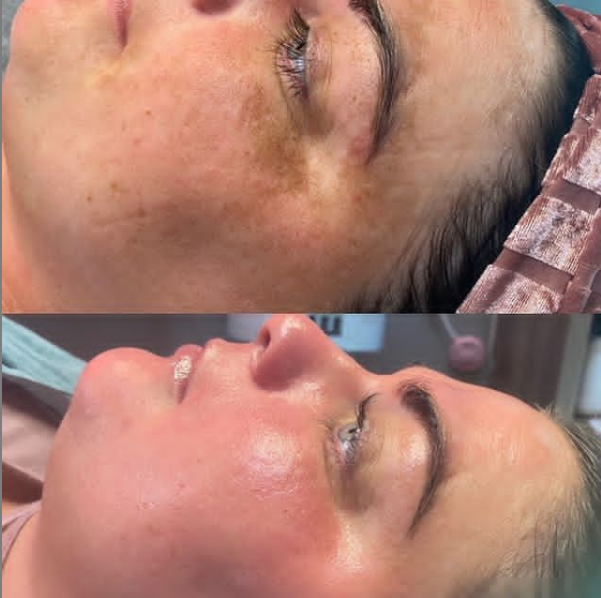 before and after 1a.PNG