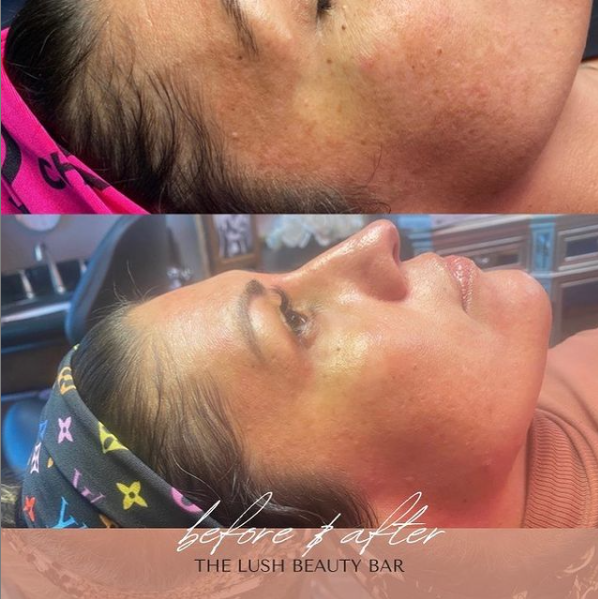 before and after 1.PNG