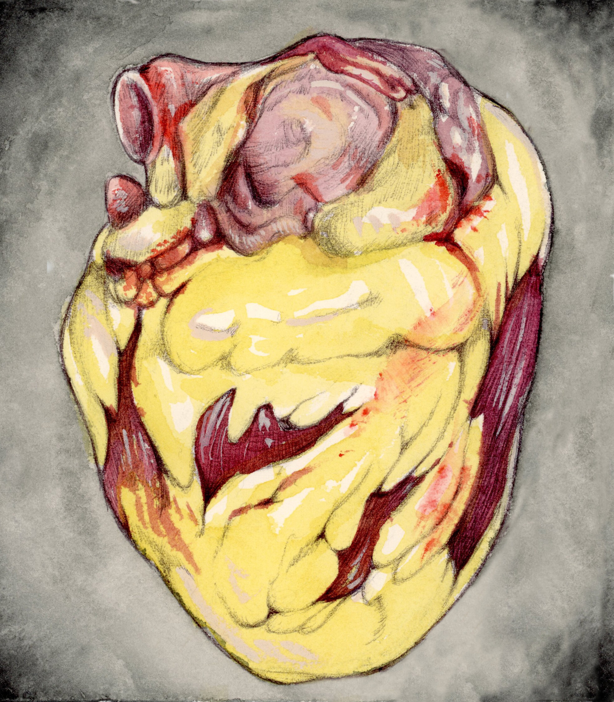 Fatty Heart