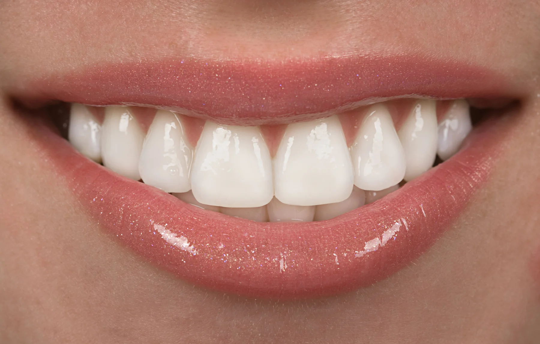 A nice, healthy smile! No cavities!
