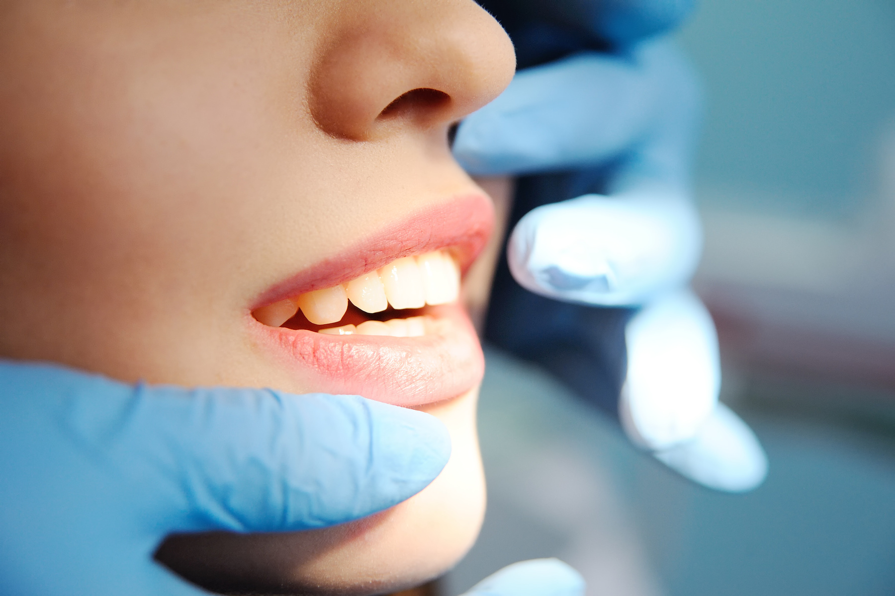 Cavity Prevention and Diet, Part 2