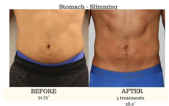 Tummy.jpg