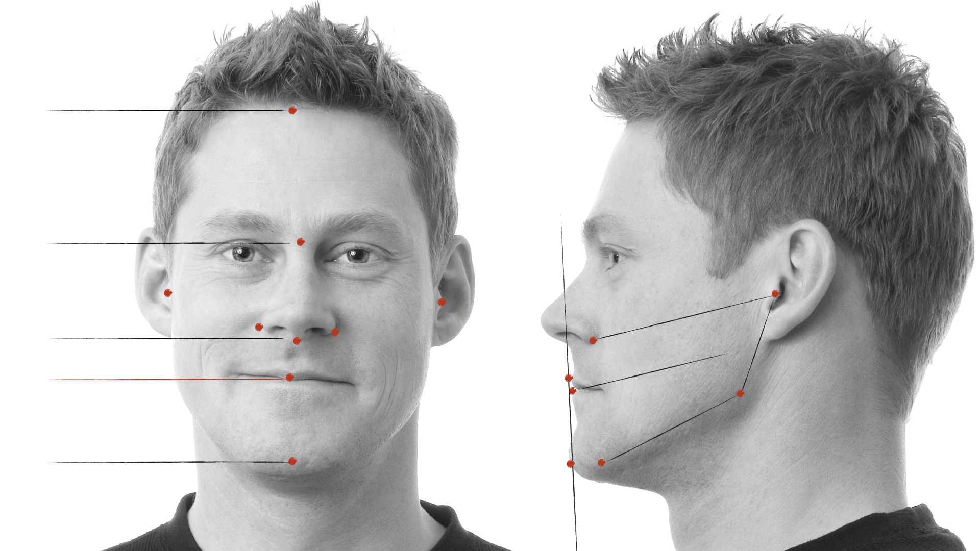dental analysis