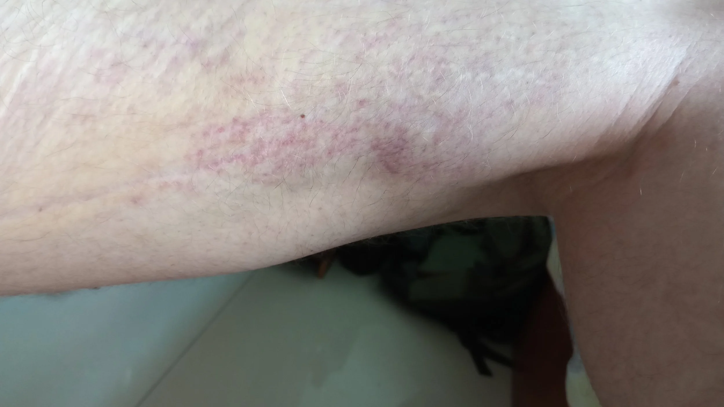 230926 blue leg 2.jpeg