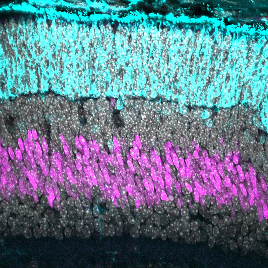 LKB1 Chx10 P5 WT Mouse 34 DAPI RDPS Chx10.jpg