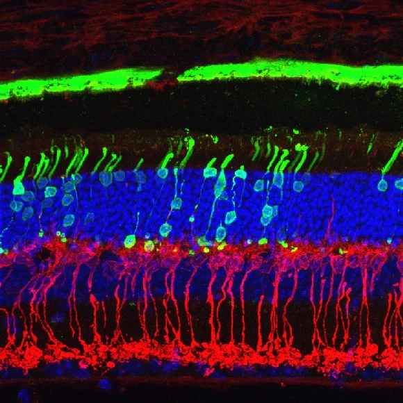 Stp15 28M MS2 gfp pkc top.jpg