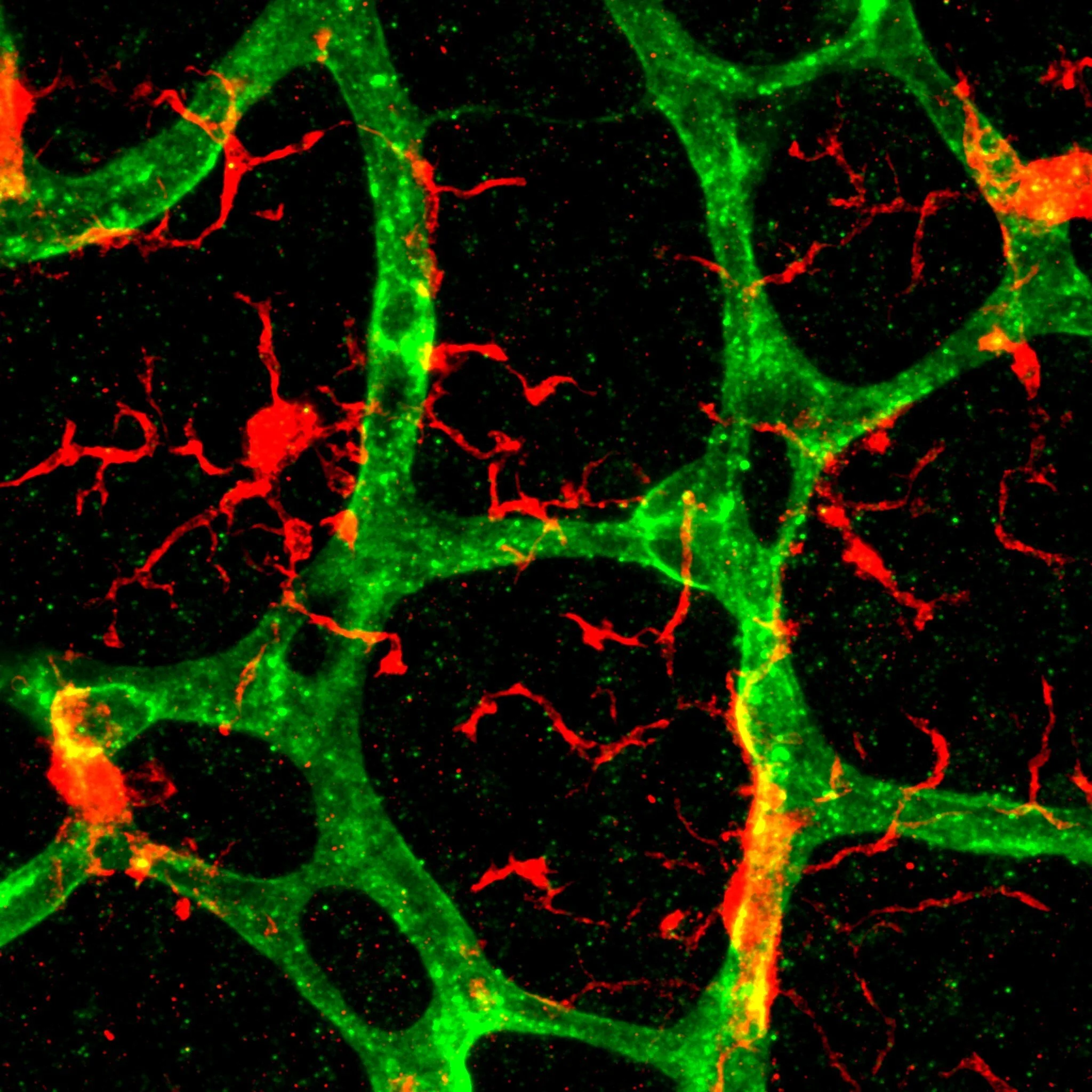 AVG_60x pvm vs tissue zpoom 2 deep layer.jpg