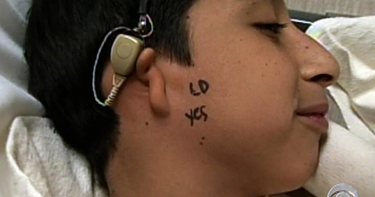 Mexican Boy Receives Miracle Ears