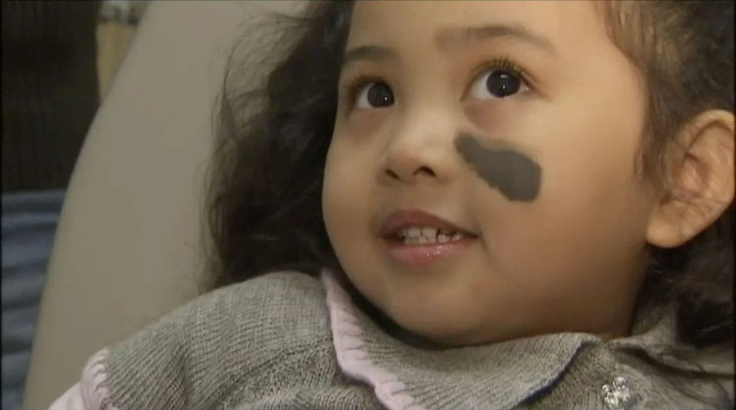 Surgeon Helps Little Girl from Phillipines