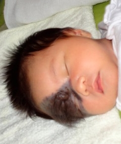 lily before.jpeg