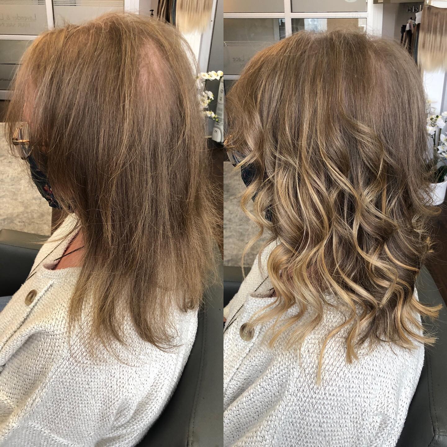 Swipe for more views. What a difference a few hours and a little hair can make. This clients suffered significant hair loss in the past. She has been dealing with it for years and finally worked up the courage to even come and talk to anyone about it