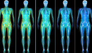 A DEXA Scan shows you the distribution of fat throughout your body. We all know that muscle weights more than fat, but did you know that there is ‘healthy’ and ‘unhealthy’ fat throughout the body?
