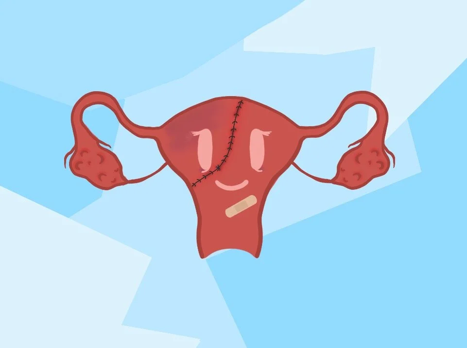 Endometriosis Surgery 