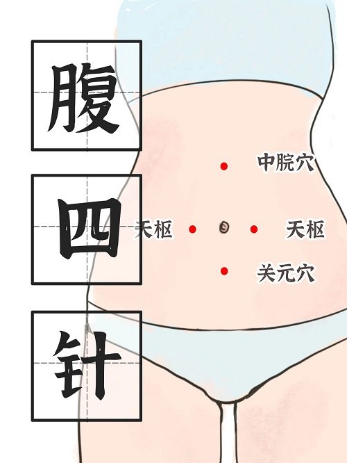 腹四针：中医治未病的经典疗法与现代应用— Wu Healing