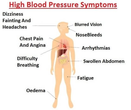 high blood pressure symptoms dizziness)