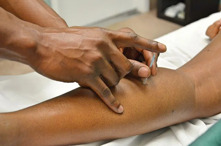 acupuncture.jpg
