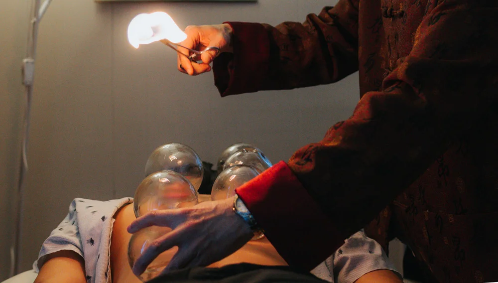 Cupping Therapy Certification Workshop with Dr. Ming Wu