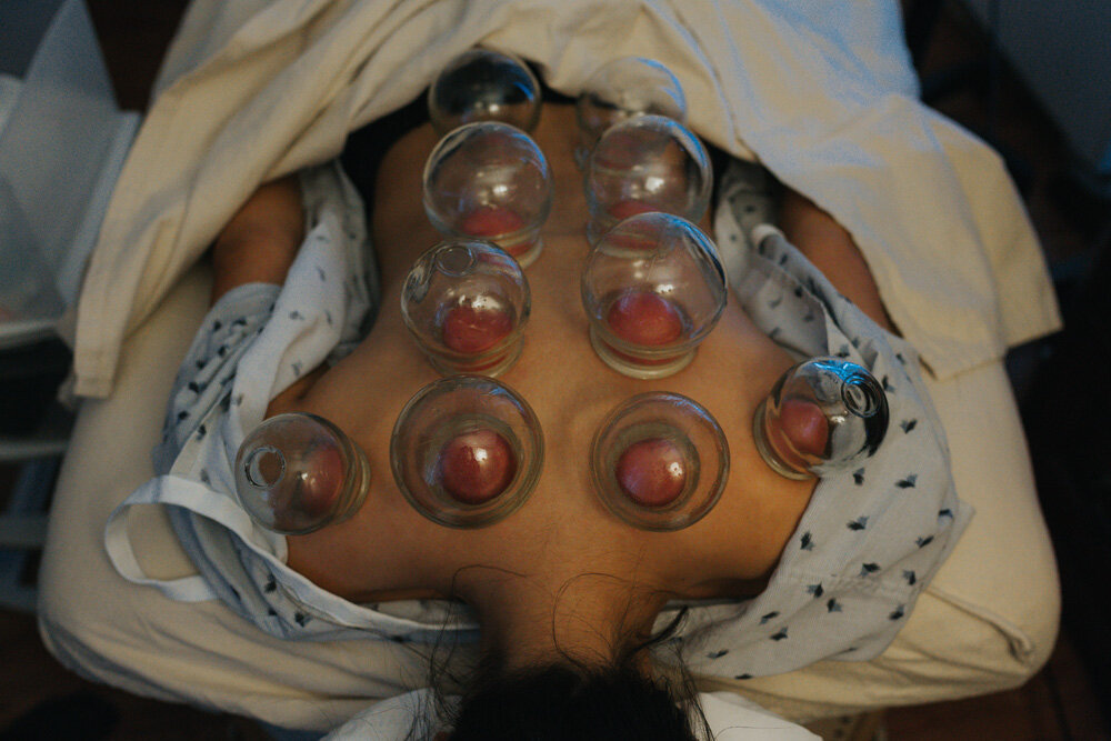 Cupping + Gua Sha Certification Workshop