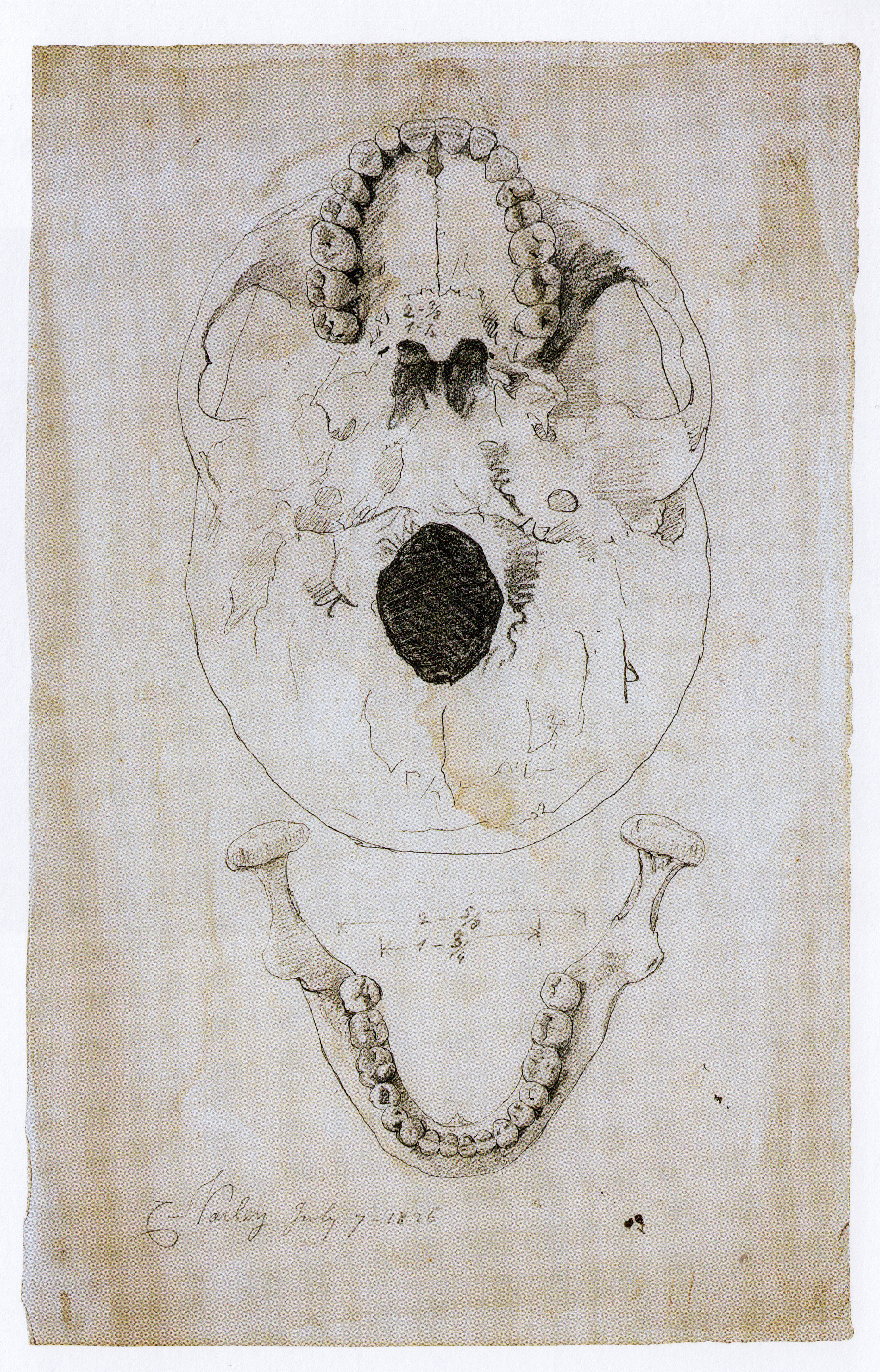  Cornelius Varley, Measured Drawing of Skull (1826). Made to demonstrate the Patent Graphic Telescope’s ability to execute precise, measured drawing. 