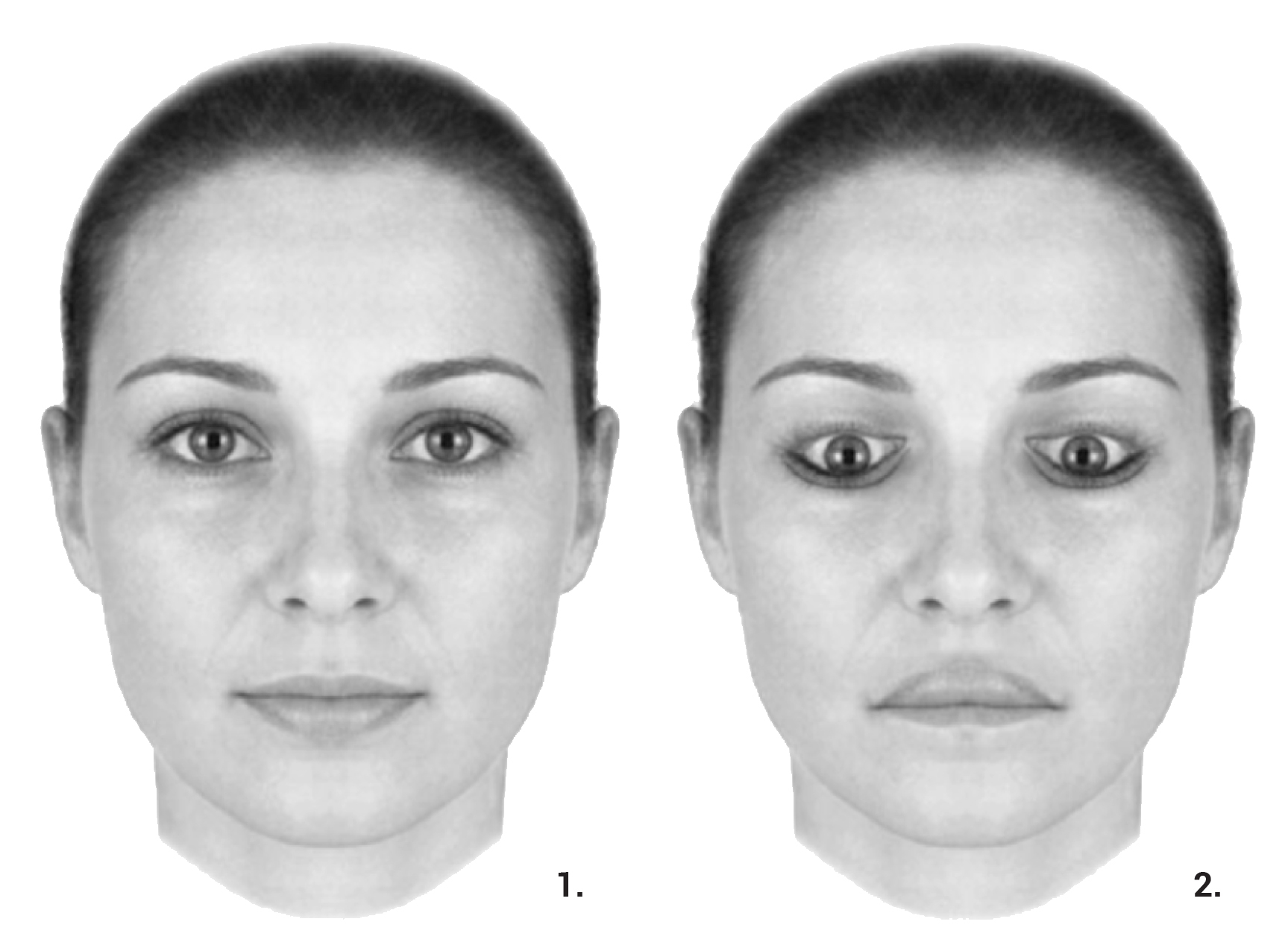   Example of the “Thatcher Effect”, from Little et al, “The many faces of research on face perception”, Philosophical Transactions of the Royal Society, 2011.  