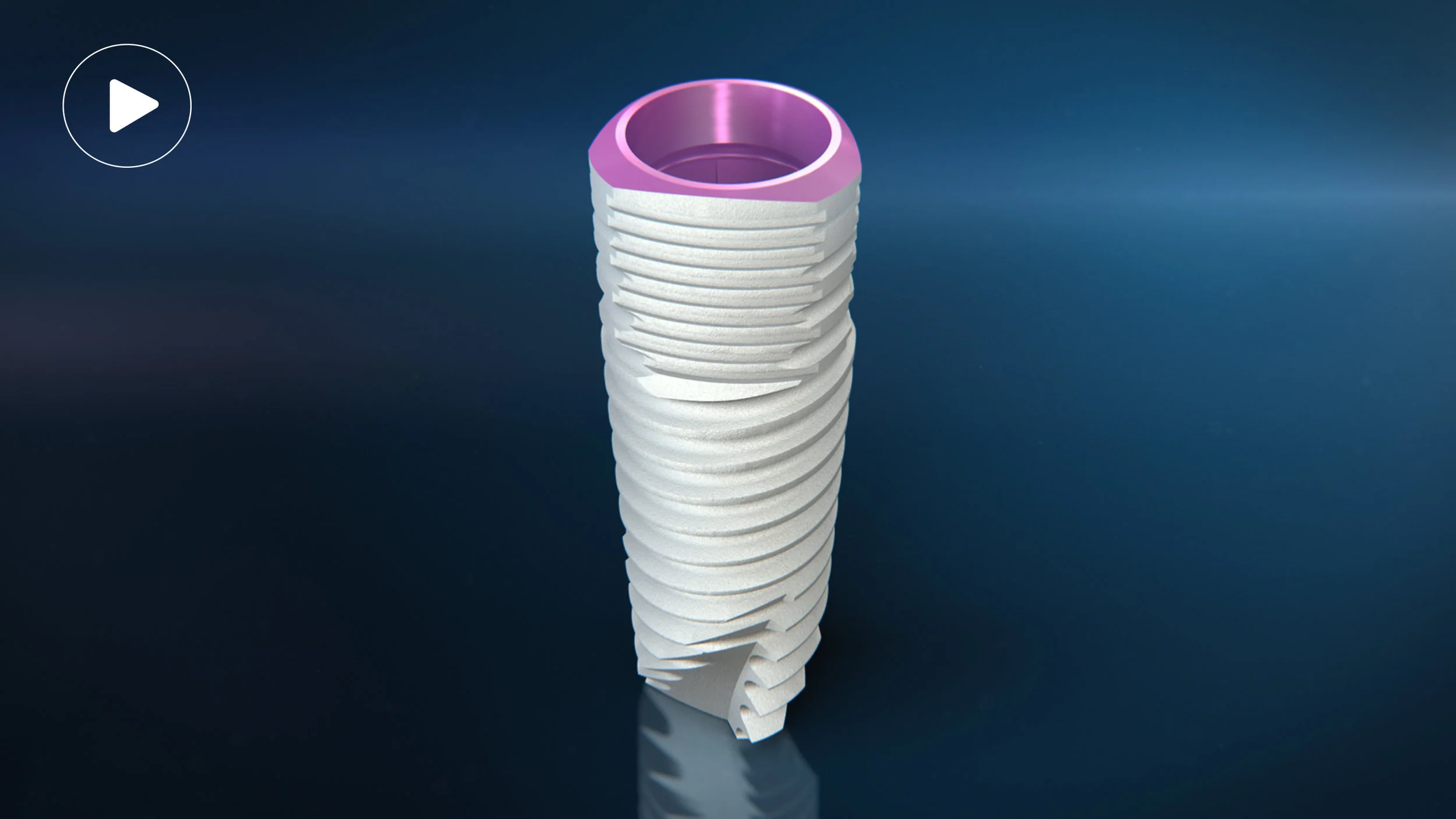 V3 Implant