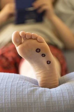 32448773_S_Feet_Warts.jpg