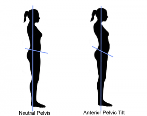 PelvicTilt.png