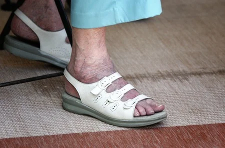 39552882_S_senior_sandles_woman_vericose_veins_rug.jpg