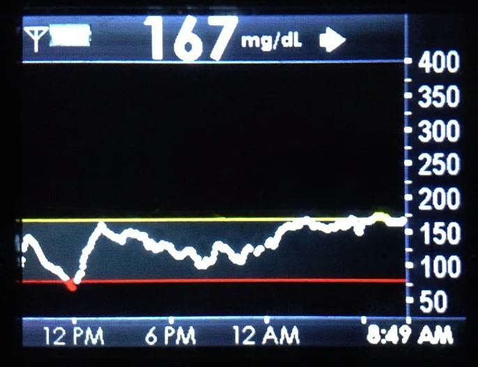 This is the screen on my Dexcom receiver.