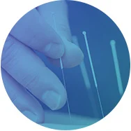 acupuncture-sml.jpg