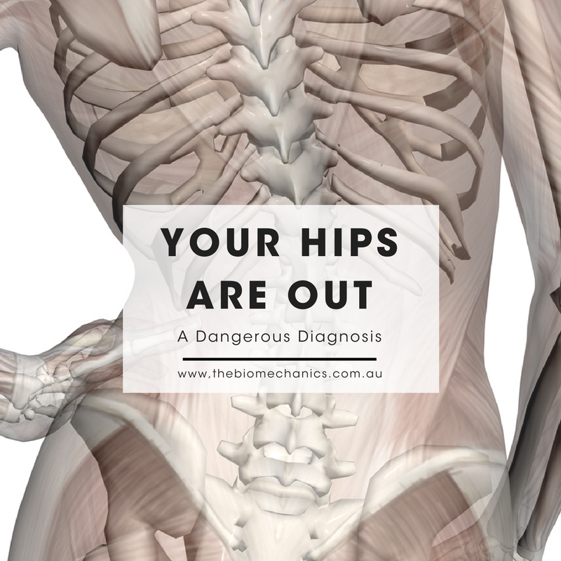 hips are out.png