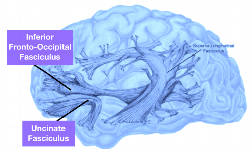 William Hirstein. Diagram by Katie Reinecke., White matter fiber tracts , colour by BrainPost, CC BY 3.0