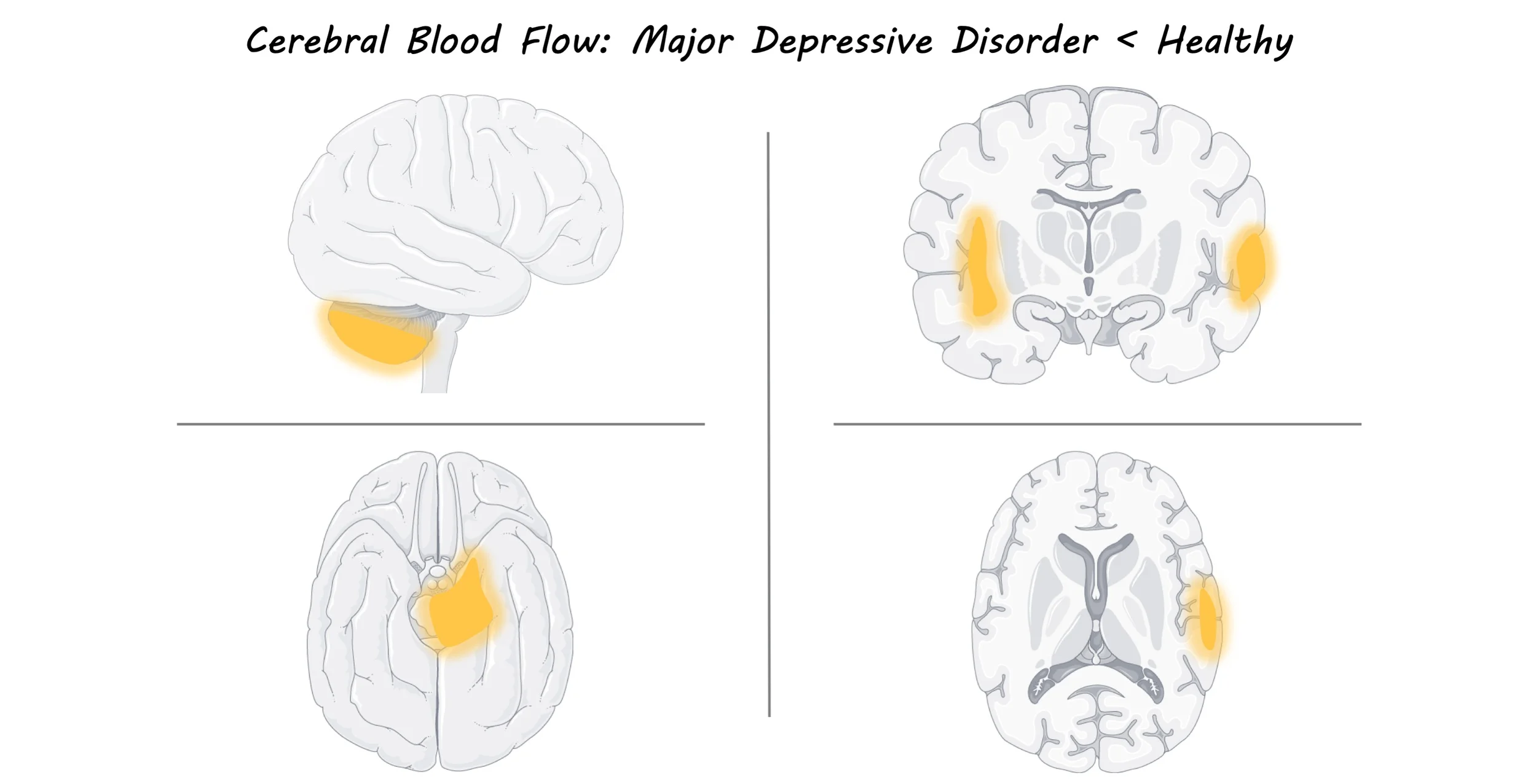 MDD_image.jpg