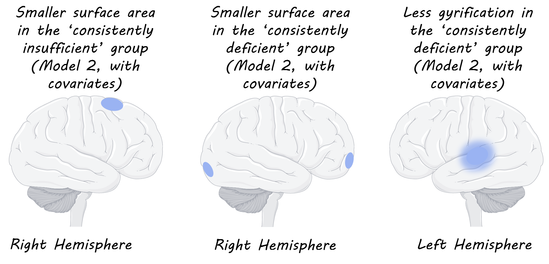 The Relationship Between Vitamin D and Brain Morphology in Children