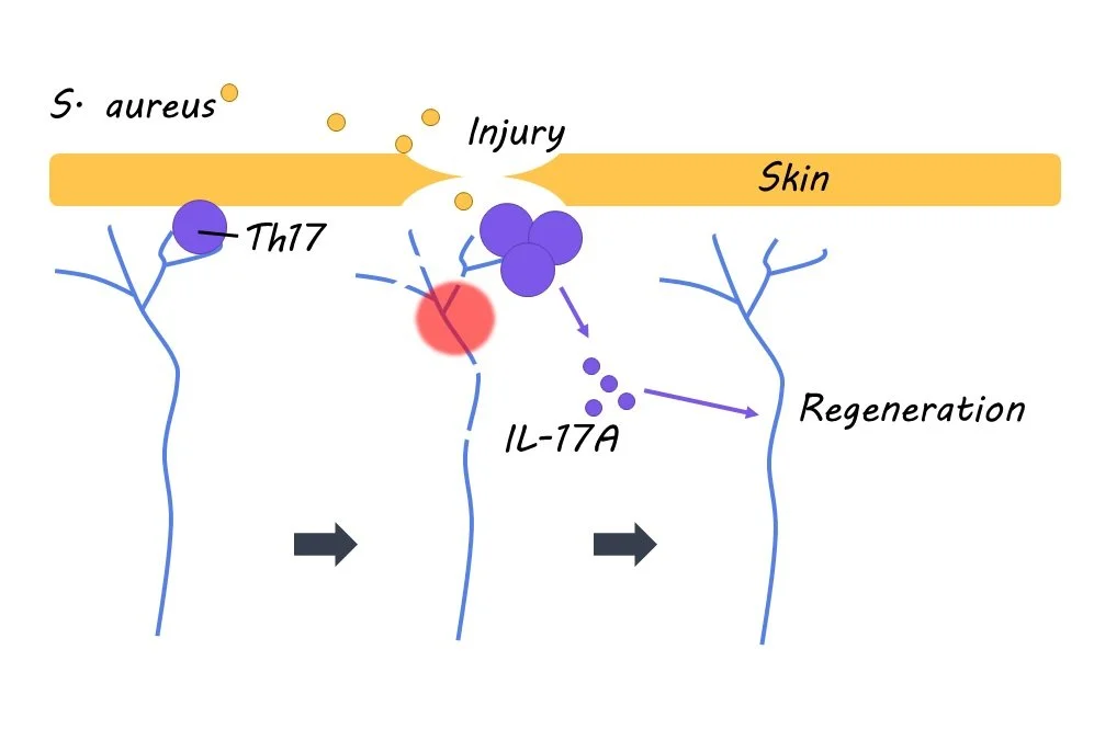 Microbiota-Induced Immune Activation Promotes Sensory Neuron ...