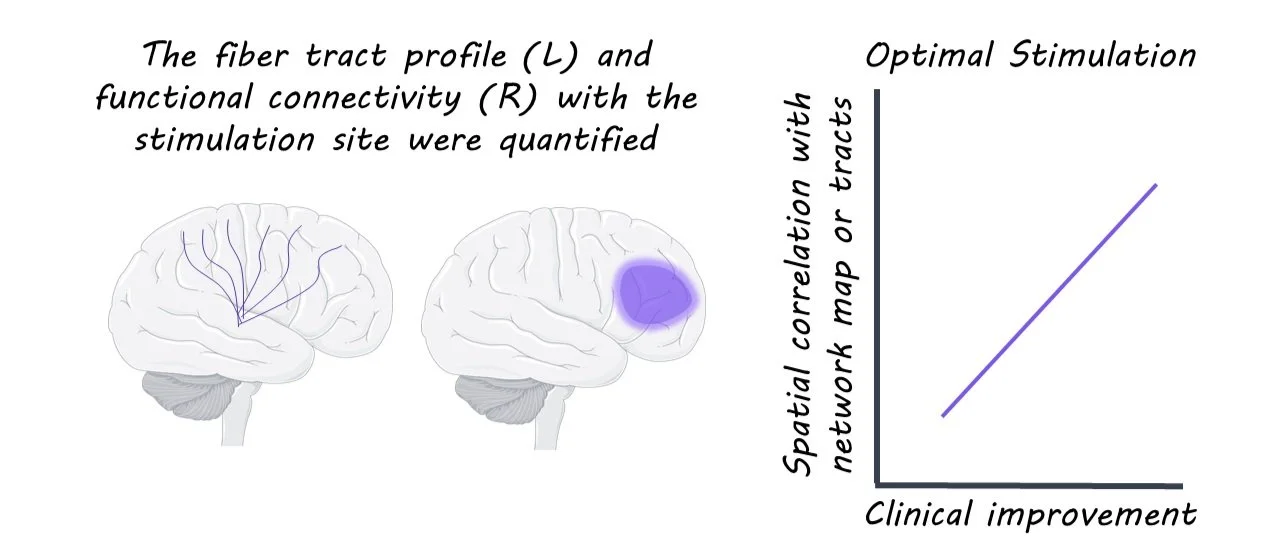 Deep Brain Stimulation in Alzheimer’s Disease — BrainPost | Easy-to ...