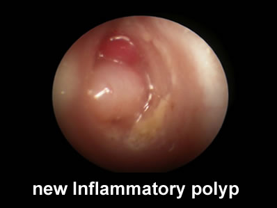 otoscopic 1.jpg