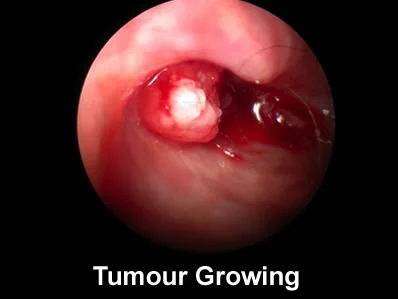 otoscopic 3.jpg